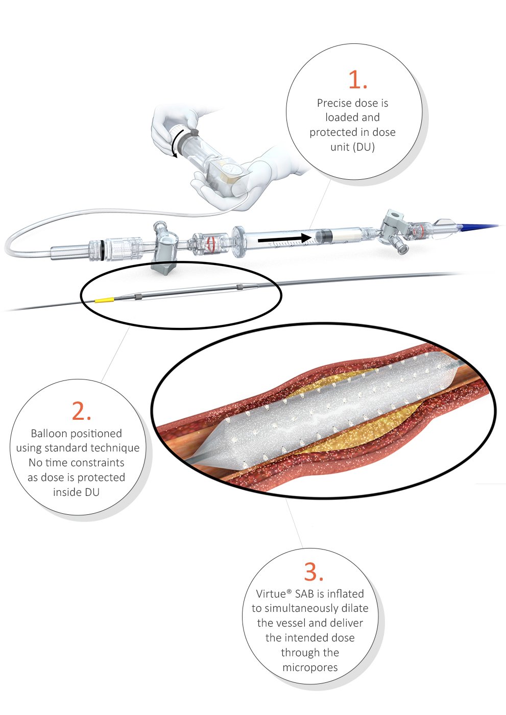 Novel AngioInfusion Balloon