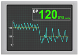 bioelectronic therapy